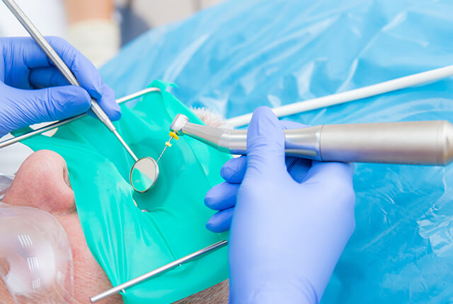 患者の歯の根管治療を行う歯科医師