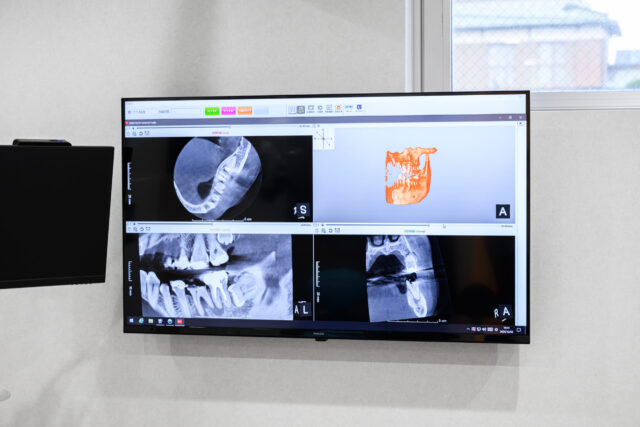 説明用大型モニター