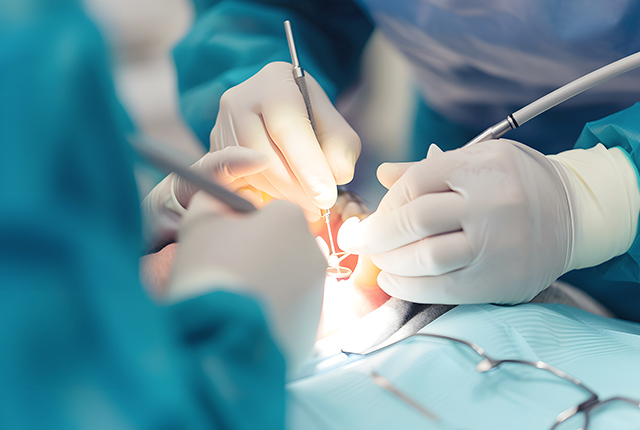 口腔外科治療の様子